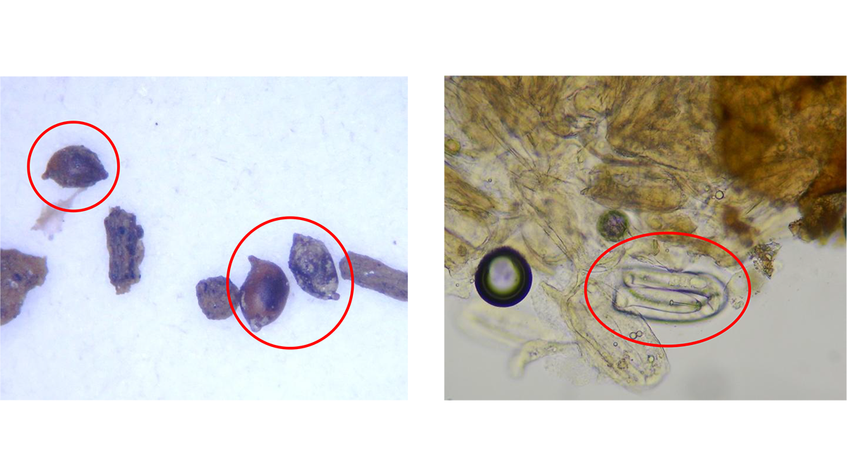 【特殊報】キャベツにテンサイシストセンチュウ　県内で初めて発生を確認　愛知県